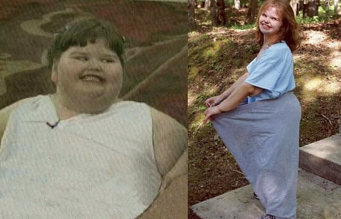 The girl weighed 220 kg at the age of 7, look how she looks now - NEWS FROM  MEDIABLOG