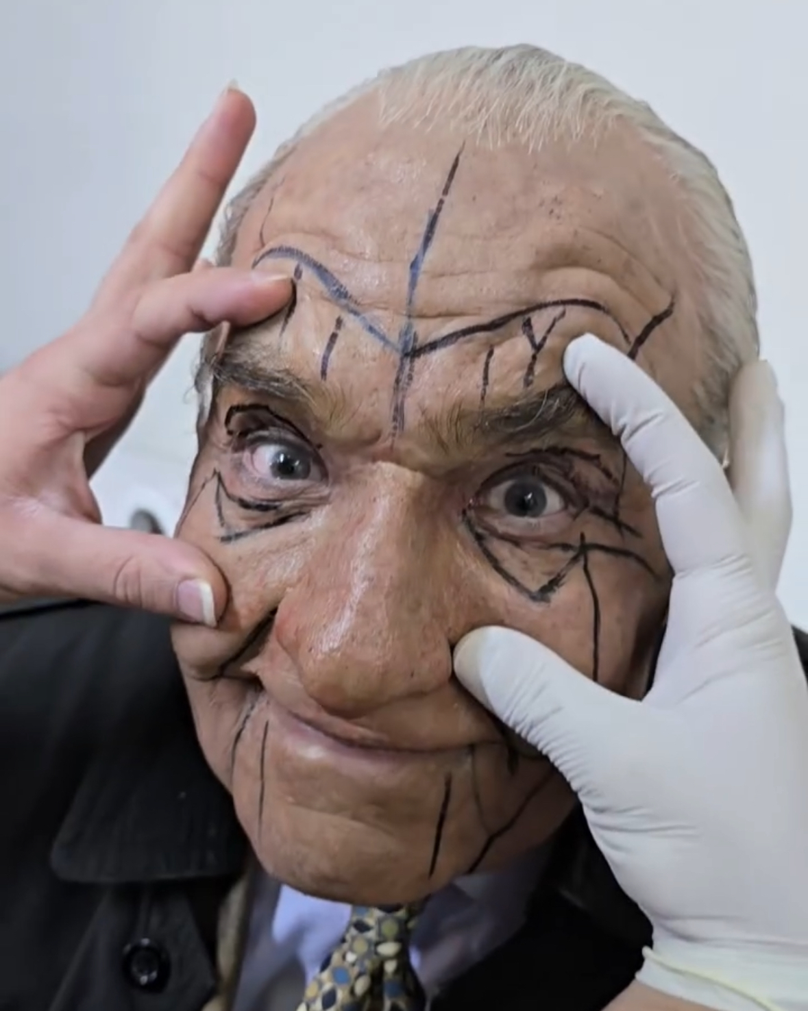 Just look at how the surgery transformed him — this man looks almost